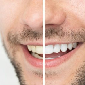 image_123650291 image_123650291